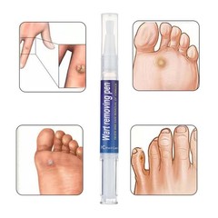 2*5ml Warts Removal Pen Eliminate Wart Pen Filiform Warts Flat Warts Remove US