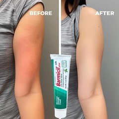 Plus Cream Skin Allergies Aloe Vera with 1% Hydrocortisone Maximum Strength Anti