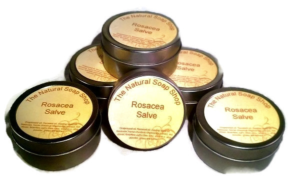 Get Relief Rosacea Healing Salve w/Cats Claw, Feverfew, Licorice, Red Clover +