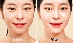 WHITESILK Retinaldehyde (4000ppm) & Bakuchiol Anti-Wrinkle SUPER Cream (30ml)