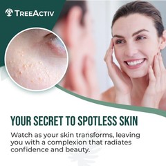 TreeActiv Spot Care 0.5oz + Remover Kit Bundle, Includes 0.5 Ounce