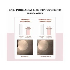 SKIN1004 Madagascar Centella Poremizing Fresh Ampoule Oily Combination Skin 30ml