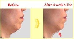 WHITESILK Retinaldehyde (4000ppm) & Bakuchiol Anti-Wrinkle SUPER Cream (30ml)