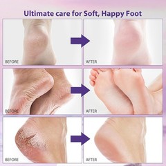 2/6/12 Pairs Exfoliating Foot Peel Mask Baby Soft Feet Remove Dead Skin Calluses