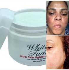 WHITE FADE SUPER SKIN LIGHTENER; PARA REMOVER MANCHAS OSCURAS DE LA PIEL, 2oz