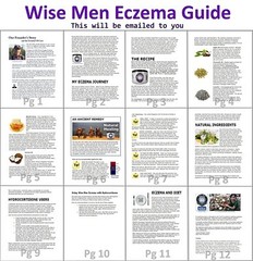Eczema Relief Balm – Natural Skin Soothing Cream – An Essential Oil Remedy