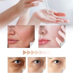 Evagloss Dark Spot Serum with Kojic Acid 1oz Natural Skincare Brightening Serum