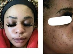 2*Skin Lightening Cream Extra Strength Lighter FAST Result-NO SIDE EFFECTS