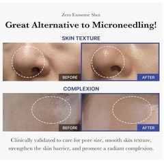 Medicube Zero Exsome Shot 7,500 PPM Facial Serum, Liquid Skin Booster | 30ml