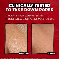 3oz Alcohol-Free Witch Hazel Toner for Hydration & Pore Reduction – Rose Scent