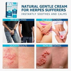 Herbal Herpes Cream – Non-Irritating, Fast Relief for Sensitive Skin – 2 oz