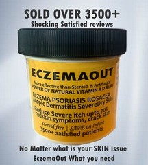 Intense Treatment Cream for Eczema Psoriasis Rosacea Dermatitis Eczemaout Acne