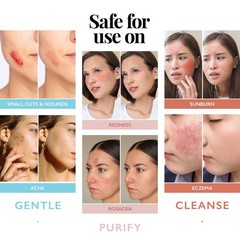 Hypochlorous Acid Spray for Face and Skin; Facial 8 Fl Oz (Pack of 1), Blue