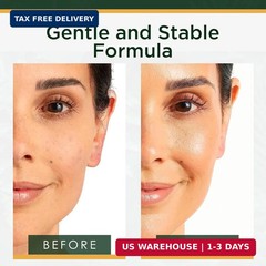 Tree of Life Vitamin C Serum For Face – Brightening Face Oil for Dark & Age Spot