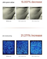 TONIER 1-Noble Shot 5ml x 8pcs Colostrum Exosomes 4th Generation Spicule Ampoule