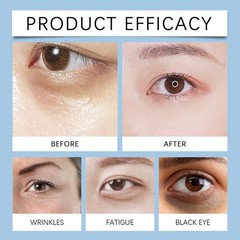 20-Pack Anti-Aging Eye Serum | Reduces Bags, Dark Circles, Wrinkles | Firming