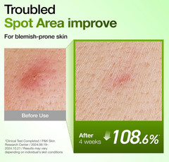 Anua Azelaic Acid 10 Hyaluron Redness Soothing Serum, Blemish / Oily-Prone Ski
