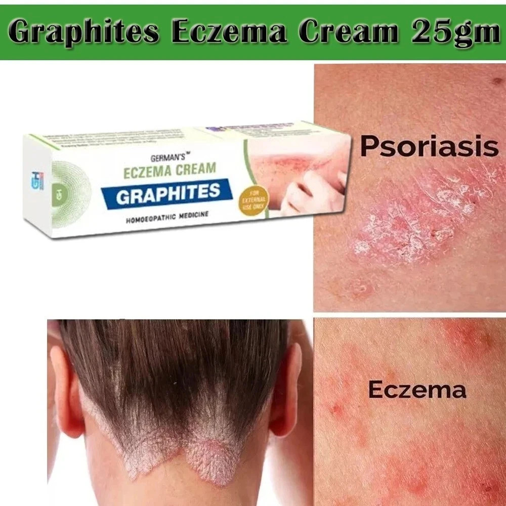 SKIN OINTMENT BODY PSORIASIS DERMATITIS ECZEMA NATURAL TREATMENT CREAM 25G