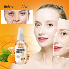 Turmeric Serum for Dark Spots，2 PCS Face 1.01 Fl Oz (Pack of 2)