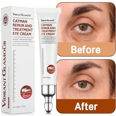 28 Seconds Fast Remove Eye Bags Dark Circles Eye Wrinkles Anti Aging Eye Cream