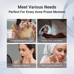 Dr.Leo 24H Acne & Pimple Treatment Drying Lotion | Salicylic Acid + Sulfur+ Niac