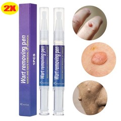 2Pack Wart Remover Pen Skin Tag Mole Remover Eliminate Foot Corn Warts Woman Man