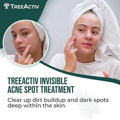 Salicylic Acid Cystic Acne Spot Treatment, 0.5 Fl Oz, Acne Treatment for Face…