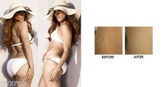120 ML – BIOPEPTIDE™ CL IRON OUT STRETCH MARKS & WRINKLES