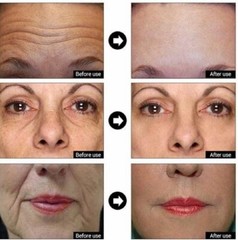 2 Pk – Matrixyl 3000, Argireline Hyaluronic Acid AntiAging Wrinkle SERUM + CREAM