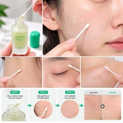 VIRENNE Spot X Powder Spot Serum 15ml Korean Spot Care Overnight Made in Korea