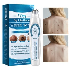 5PC Tag&Spot Eraser Mole Skin Tags Removal Tool Eraser Pen Painless Long-Lasting