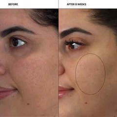 Skin Pharm Crystal Clear Clarifying Pads – 60ct w/2% Salicylic Acid
