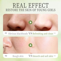 HUNMUI Compound Acid Avocado Bubble Mask 4gx12