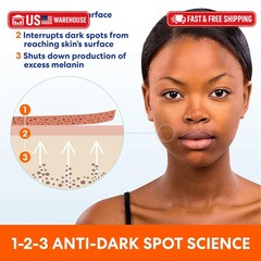 Palmer&rsquo;s Skin Success Anti-Dark Spot Fade Cream with Vitamin E and Niacinamide,