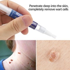5X 5ml Warts Removal Pen Eliminate Wart Pen Wart Liquid Hand Foot Warts Remove