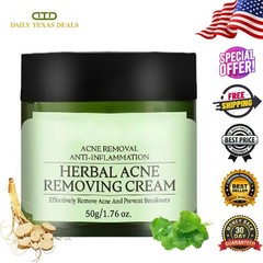 Natural Acne Removal Cream for Oily & Combination Skin | Clears Pimples & Pores