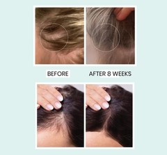 Advanced Hair Growth Serum for Hair Fall Control & Hair Growth – 3% Redensyl,…