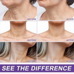 AH-8 Firming Neck Cream 4.23oz – Advanced Hydration and Lift for Youthful Skin