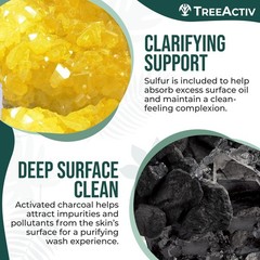 Sulfur 10% Exfoliating Charcoal Acne Face Wash, 8 Fl Oz