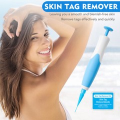 2-8 mm Micro Auto TagBand Skin Tag Remover Device for Small to Medium Skin Tags