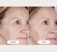 CurrentBody Skin LED Light Therapy Mask Series 2 – New Open Box