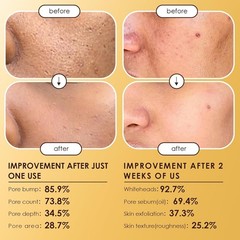 2PCS PEEL Dr.Melaxin SHOT GLOW EXFOLIANT RICE AMPOULE (WHITE RICE/BLACK RICE)
