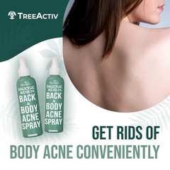 TreeActiv Salicylic Acid Back & Body Acne Spray, Fine Mist Spray 4 Ounce