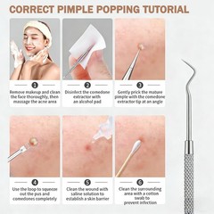Blackhead Remover Pimple Popper Tool Kit 6 Pcs wan-6-piece, Silver