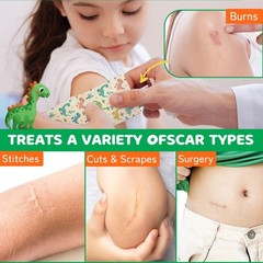 Silicone Scar Sheets for Kids Scars: Dinosaurs 1.6&Prime;x 60&Prime; Roll, Multicolor