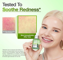 Anua Azelaic Acid 10 Hyaluron Redness Soothing Serum, Blemish / Oily-Prone Ski
