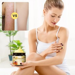 Bee Venom Treatment Cream, 2026 New Professional Bee Venom Repair Cream, For …