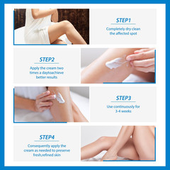 Urea Cream 40 Percent for Feet,40% Urea 2% Salicylic Acid Foot Cream,Foot Cream