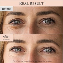 2pc Beauty of Joseon Revive Eye Serum with Retinal Niacinamide Correction 50ml