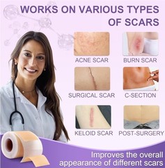 Silicone Scar Sheets Advanced Medical Silicone Scar Tape (1.6&Prime;x 60&Prime;Roll-1.5M 2pk